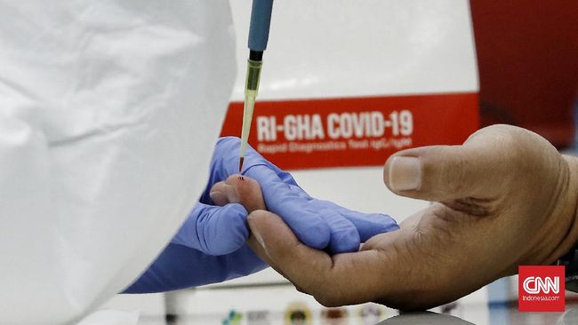 Rapid Tes Corona RI-GHA Covid 19 Petugas kesehatan menggunakan alat rapid diagnostic test Corona RI-GHA COVID-19 di ruang Heritage, Kemenko PMK, Jakarta. Kamis (9/7/2020). CNN Indonesia/Andry Novelino