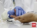 Studi: Antibodi Susut, Corona Bisa Infeksi Berkali-kali