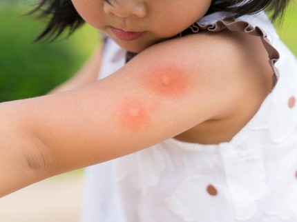 Cegah Alergi Anak, Ini Manfaat Sinbiotik bagi Si Kecil