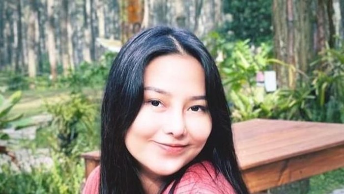 Warganet menyebut bentuk hidung Dara Arafah aneh pasca operasi plastik. Cuek dan santai hadapi hujatan netizen, Dara Arafah mengatakan hidungnya masih bengkak dua minggu pasca operasi. (Foto: https://www.instagram.com/daraarafah/)