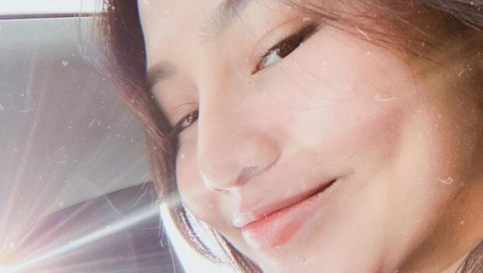 Hindari lebih banyak hujatan untuk dirinya, Dara Arafah memilih untuk menutup kolom komentar di postingan terbarunya di Instagram. Baik sebelum dan sesudah operasi, Dara Arafah tetap punya senyum manis andalannya kok. (Foto: https://www.instagram.com/daraarafah/)