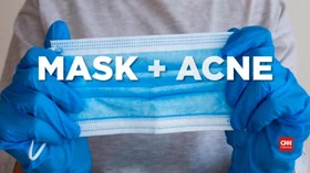 VIDEO: Tips Mengatasi Jerawat Akibat Pakai Masker