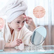 Alami Kulit Wajah Kering dan Iritasi? Coba Atasi dengan Cara Mudah Ini, Yuk!