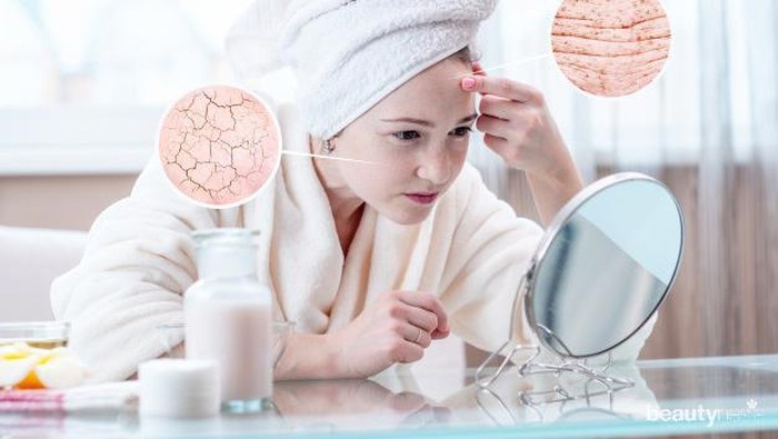 Alami Kulit Wajah Kering dan Iritasi? Coba Atasi dengan Cara Mudah Ini, Yuk!
