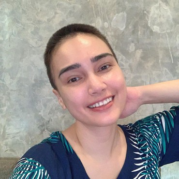 Jalani Kemoterapi Terakhir, Feby Febiola Minta Doa dan Harapan Baik