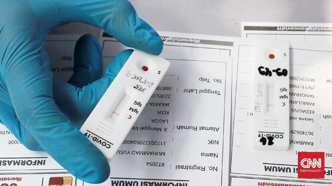 Dinas Kesehatan Provinsi DKI Jakarta akan menindaklanjuti temuan BPK terkait pengadaan rapid test antigen dan masker N95.