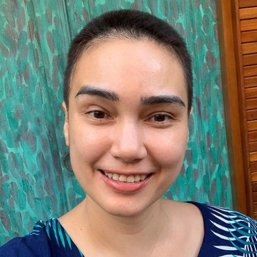 Feby Febiola Alami Kerontokan usai Kemoterapi, Begini Penjelasan Dokter