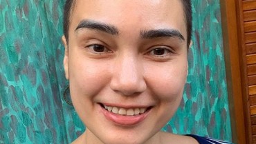 img-title Feby Febiola Alami Kerontokan usai Kemoterapi, Begini Penjelasan Dokter