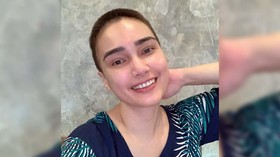 Feby Febiola Ungkap Idap Kanker Ovarium
