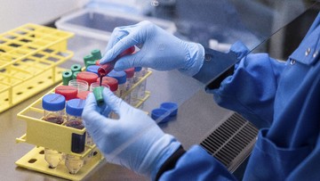 Pemerintah Bayar DP Vaksin AstraZeneca Rp36,7 T Akhir Bulan Pemerintah menyebut akan menyetor uang muka 50 persen atau Rp36,7 triliun dari total pengadaan 100 juta vaksin corona dari AstraZeneca.