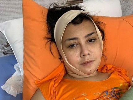 Kondisi Kakak Elma Theana Usai Jadi Korban Malapraktek Klinik Kecantikan