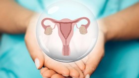8 Gejala Kista Ovarium yang Patut Diwaspadai