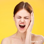 Cara Mengatasi Bekas Jerawat Kemerahan