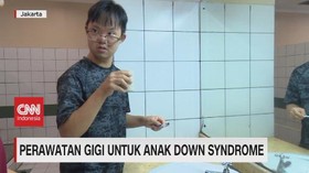 VIDEO: Perawatan Gigi Untuk Anak Down Syndrome