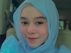 Lesti Kejora Makin Cantik, Perawatannya Dari Botox Sampai Tanam Benang