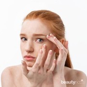 Waspadai Tanda Ini Jika Kamu Mengalami Over Eksfoliasi