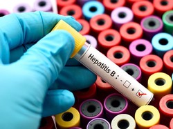 Ayo Deteksi Dini Hepatitis B!