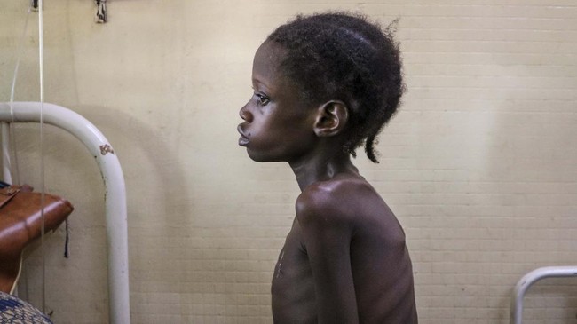 FOTO: Terjebak Pandemi dan Konflik Bersenjata di Burkina Faso