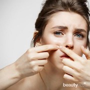 Hobi Memencet Jerawat? Ini Bahaya yang Bisa Muncul