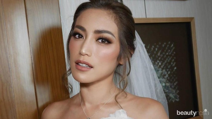 Mengenal Penyakit Graves Diseases Autoimmune Hyperthyroid yang Dialami Jessica Iskandar