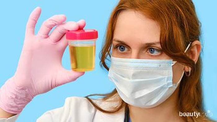 Cari Tahu, Yuk! Ini Arti Warna Urine Sebagai Tanda Kesehatan