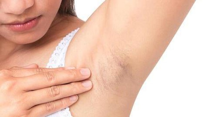 Inilah Alasan Kenapa Bulu Ketiak Tak Bisa Tumbuh Sepanjang Rambut