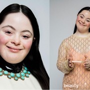 Ellie Goldstein, Model Cantik dari Gucci Beauty yang Istimewa