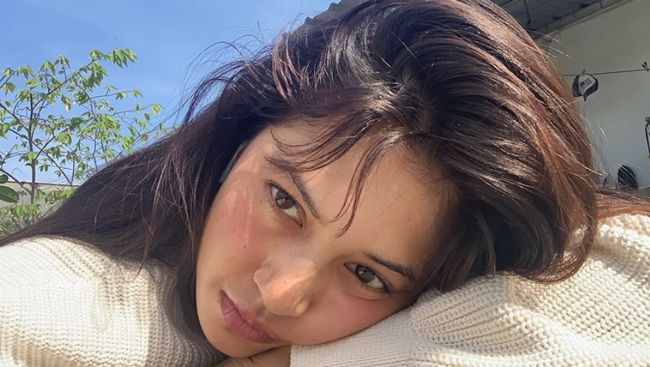 Aurelie Moeremans blak-blakan soal kesehatan yang membuatnya belum membintangi proyek apapun saat ini. Ia idap Tumor Colli.