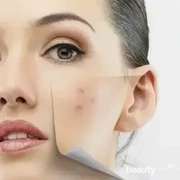 Produk-Produk Ini Terbukti Ampuh Hilangkan Bekas Jerawat