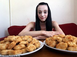 Alami Phobia Makanan Langka, Wanita Ini Hanya Makan Nugget