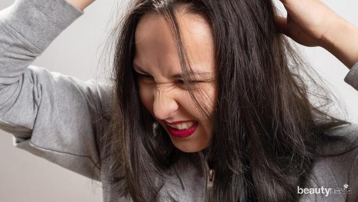 Kulit Kepala Kering dan Gatal? Ini Cara Mengatasinya