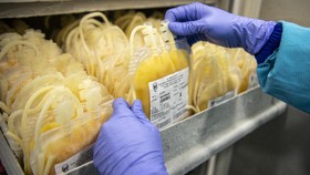 Studi: Transfusi Plasma Kurangi Kematian Pasien Covid-19