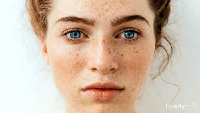 Musim Panas Bikin Wajah Hiperpigmentasi? Gak Lagi dengan Cara Ini!