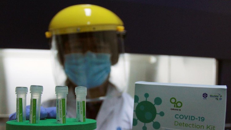 LIPI TEMUKAN ALAT DETEKSI ALTERNATIF COVID-19 Doktor Tjandrawati Mozef Peneliti Biokimia Farmasi LIPI yang juga penemu menunjukan detection kit