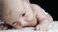 Penyebab Milia Si Bintik Putih di Kulit Bayi, Begini Cara Mengatasinya Bunda