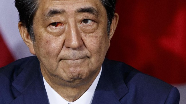 Mantan Perdana Menteri Jepang Shinzo Abe dirawat di RS Universitas Kedokteran Nara usai ditembak di bagian dada dan leher pada Jumat (8/7).