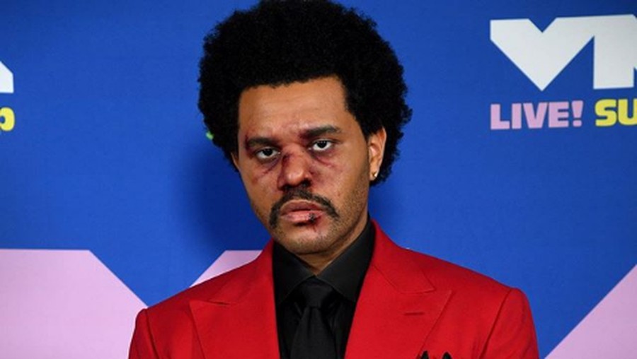 The Weeknd The Weeknd tampil dengan wajah lebam di MTV VMA 2020.