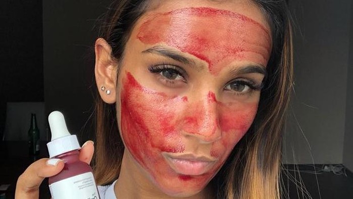 Penting! 4 Hal yang Harus Dilakukan Usai Pakai The Ordinary Peeling Solution Penting! 4 Hal yang Harus Dilakukan Usai Pakai The Ordinary Peeling Solution