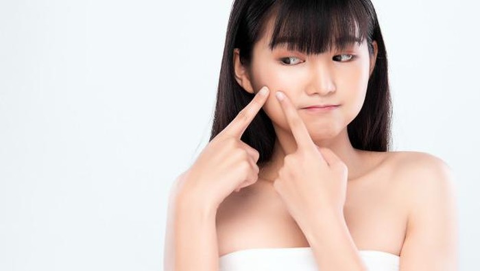 Tidak Boleh Sembarangan, Ini Obat Jerawat untuk Remaja