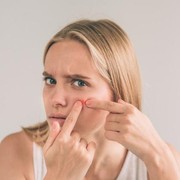 Yuk Kenali 3 Jenis Jerawat di Wajah Berikut Ini!