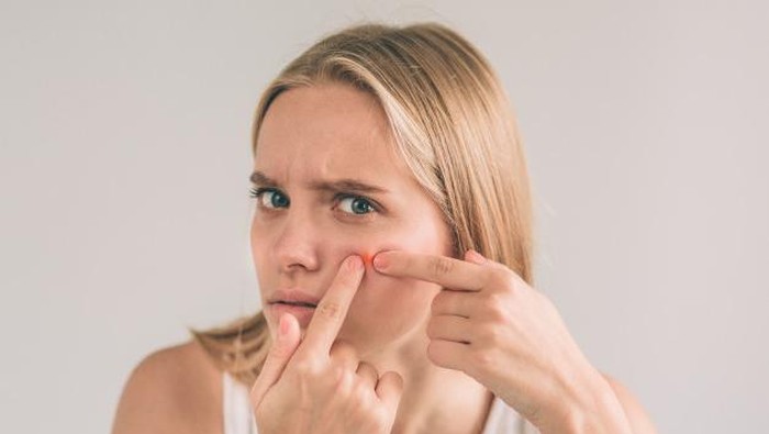 Yuk Kenali 3 Jenis Jerawat di Wajah Berikut Ini!