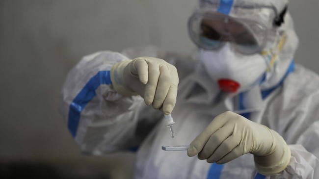 Para dokter rumah sakit di India, dalam 15 hari terakhir menemukan 13 kasus infeksi jamur hitam atau Mucormycosis yang dipicu oleh infeksi virus corona.