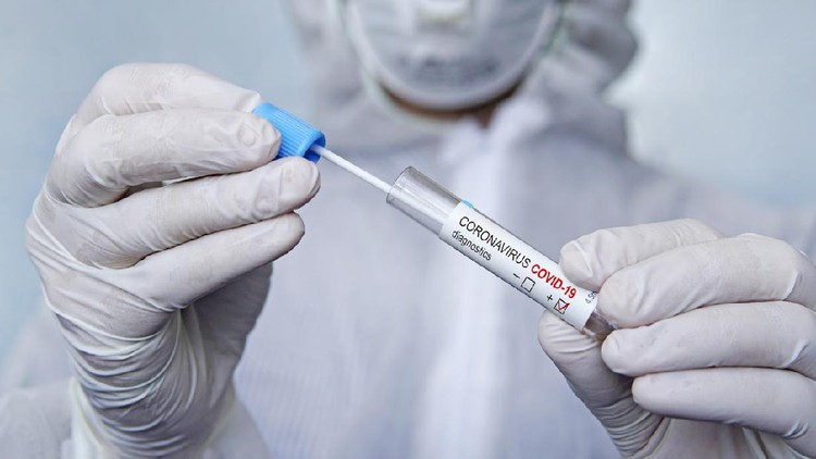 Coronavirus 2019-nCoV Sample. New Epidemic Corona Virus. Corona virus outbreaking. Corona Virus in Lab. Scientist hold tube with Test with the Virus Name Coronavirus. sputum examination