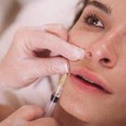 Hal Penting yang Harus Kamu Tahu Sebelum Memutuskan untuk Filler Wajah