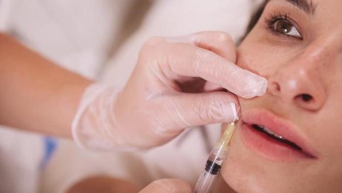 Hal Penting yang Harus Kamu Tahu Sebelum Memutuskan untuk Filler Wajah