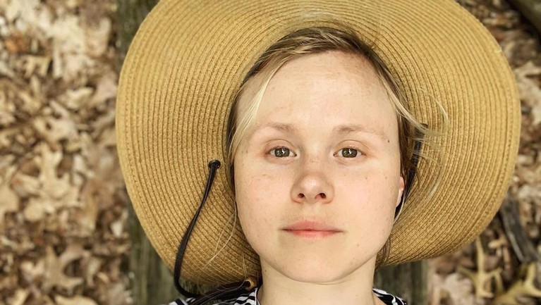 alison pill alison pill