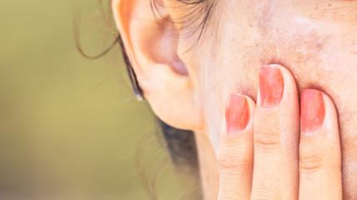 Cara Tepat Menggunakan Sunscreen Menurut Dermatologist