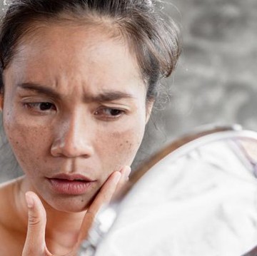 img-title 10 Do's and Don'ts yang Wajib Diperhatikan untuk Kamu dengan Kulit Berminyak