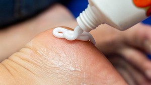BeauPicks: 4 Pilihan Foot Cream untuk Merawat Tumit Kering dan Pecah-Pecah