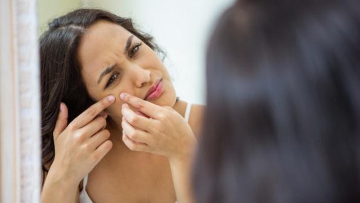 Tips Mengatasi Jerawat Karena Breakout